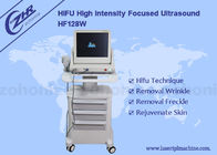 Machine focalisée de forte intensité de ride de Hifu d'ultrason anti avec l'effet durable
