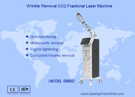 Élimination des pigments par machine laser à CO2 fractionnée verticale Élimination des cicatrices