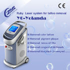 Machine à commutation de Q de beauté de chargement initial de laser de Yag du tatouage 6hz d'équipement professionnel de retrait