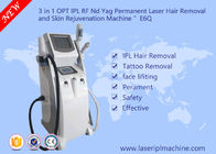 Retrait de tatouage de laser d'équipement de beauté de l'équipement de beauté de rajeunissement de peau de clinique/chargement initial