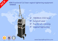 équipement partiel de laser du CO2 40w/équipement de serrage vaginal commercial