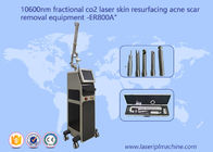 10600nm refroidissent la machine partielle de laser de CO2 de poutre pour le retrait de vergeture de cicatrice d'acné