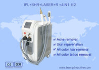 Machine de chargement initial de laser de ND YAG 530nm d'enlèvement d'acné