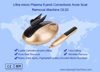 Machine ultra micro de retrait de Pen Eyelids Corrections Acne Scar de plasma