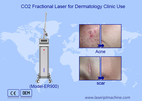 10600nm Fractionnelle Ultrapulsé Co2 Laser machine de refaçage de la peau