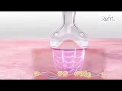 Les cellulites ultrasoniques portatives du vide rf de la cavitation MLS05 40K réduisent le dispositif