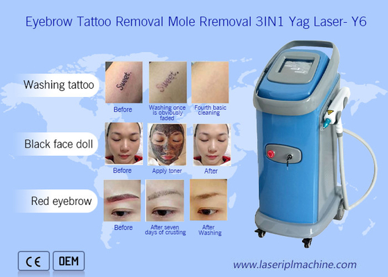 1064nm 532nm Nd Yag Laser Machine d' élimination du tatouage Dermatologie