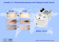 Machine de nettoyage portative de 3in1 Diamond Dermabrasion Skin Peeling Facial