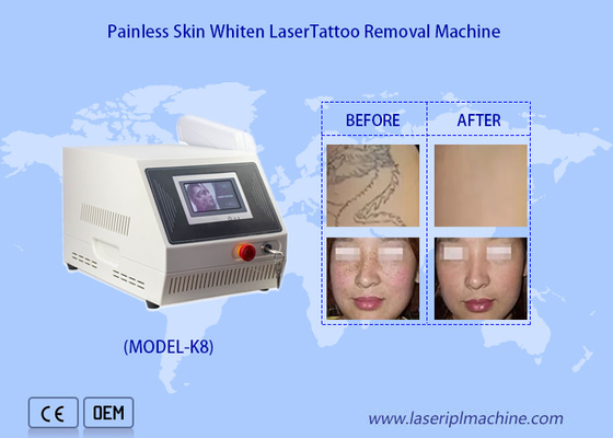 1320nm 1064nm 532nm Machine de blanchiment de la peau pour éliminer les tatouages au laser Nd Yag portable