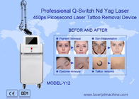 755nm machine de retrait de tatouage de laser de picoseconde de ND Yag