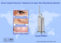 Laser de CO2 fractionné RF pour étirements, élimination de cicatrices, machine de resserrement vaginal