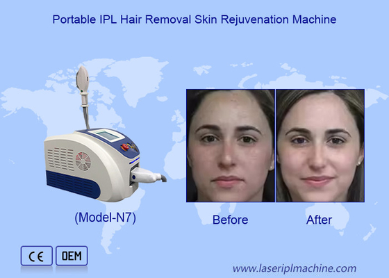Dépilation laser IPL avancée et rajeunissement de la peau avec des cristaux lumineux de saphir importés
