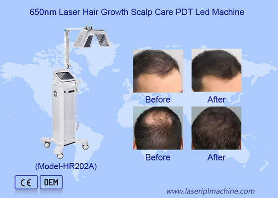 Machine de stimulation de la croissance des cheveux à haute fréquence sûre