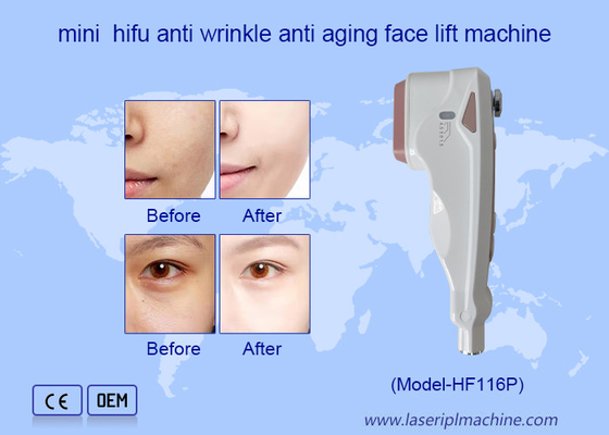 Utilisation à domicile HIFU soins du visage élimination des rides rajeunissement de la peau machine de lifting du visage