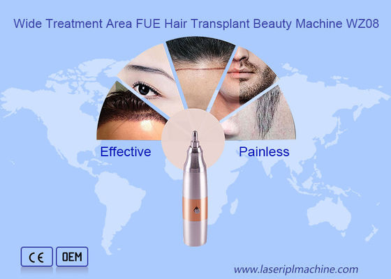 Transplantation de cheveux de qualité médicale