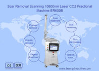 machine partielle de laser du CO2 10600nm pour reblanchir de peau