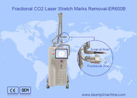 Machine partielle de laser de CO2 du balayage 10600nm 10x10mm de retrait de cicatrice