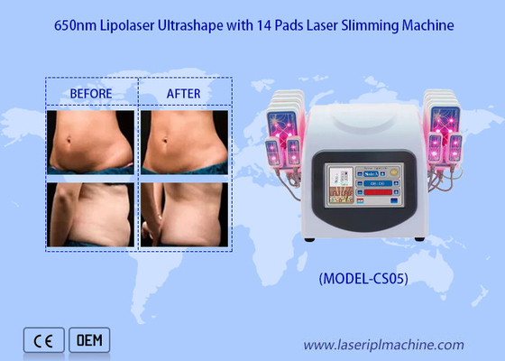 le laser de 650nm Lipo capitonne la machine de liposuccion de laser pour réduisent le gros enlèvement de cellulites