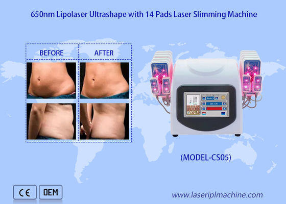 Bon prix le laser de 650nm Lipo capitonne la machine de liposuccion de laser pour réduisent le gros enlèvement de cellulites en ligne