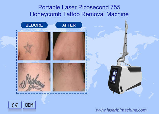 Bon prix Dispositif 755nm 1064nm 532nm de machine de retrait de tatouage de laser de picoseconde de ND Yag en ligne
