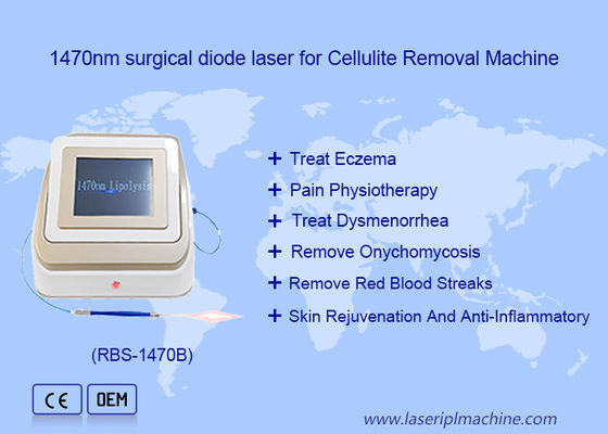 Bon prix 1470nm 980nm Diode Laser Lipolyse Chirurgie Appareil laser Soluble dans les graisses en ligne