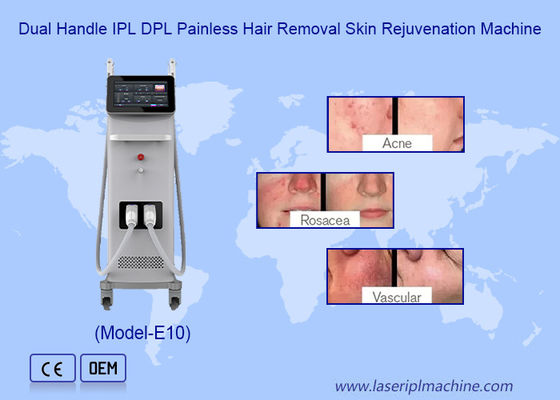 Bon prix Épilateur professionnel permanent IPL OPT, machine de dépilation pour le rajeunissement de la peau en ligne