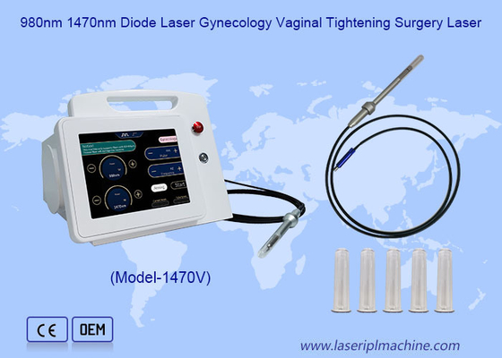 Laser à diode 980nm 1470nm  Gynécologie  Resserrement vaginal  Chirurgie laser